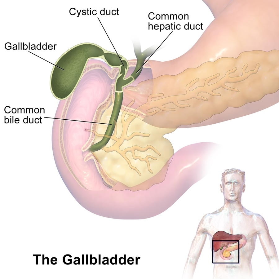 Gallbladder Diseases and Metabolic Syndrome